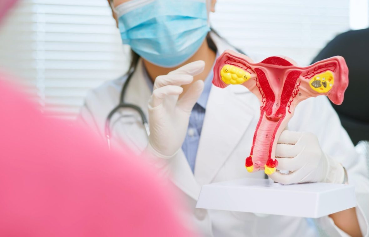 medic îi arată unei paciente un mulaj al organelor de reproducere feminine